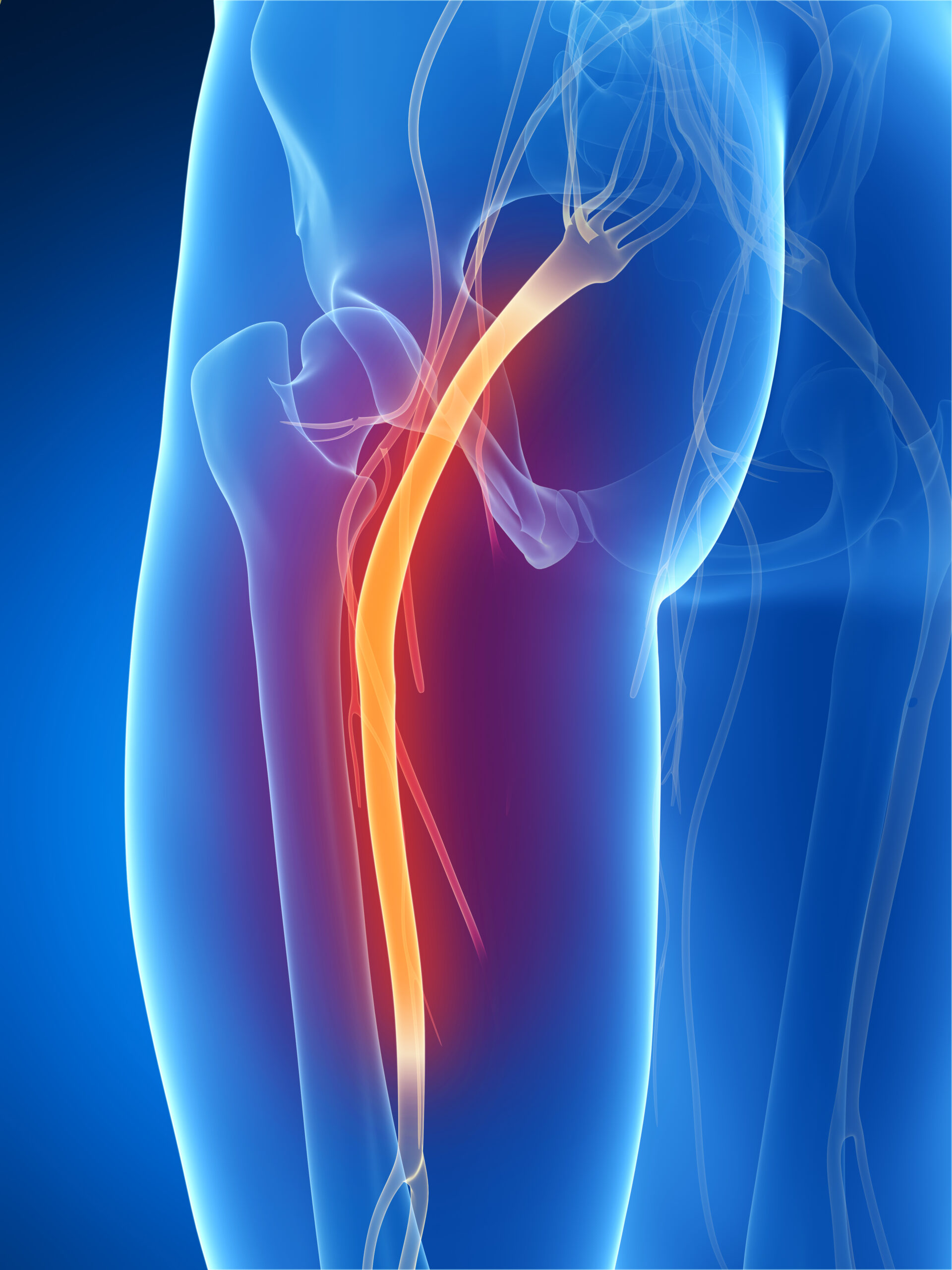 Total Knee Arthroplasty