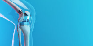 South Carolina Anesthesia Total Knee Arthroplasty